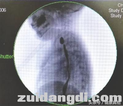 1af40005d03edca155de