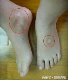 2edd000460dac1f24f44