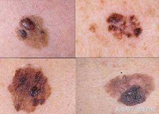 22cb00001fc04e659863