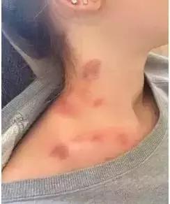 1f8200014dd1bb38b867