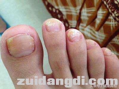 脚是身体的晴雨表，赶紧查查，有这些变化可得小心了-2.jpg