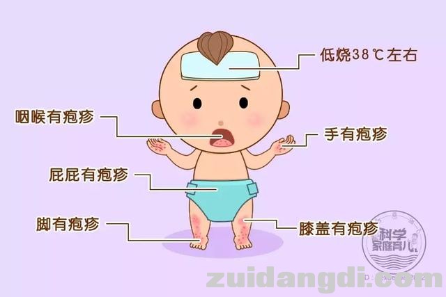 手足口病高发！娃有这4种症状，别犹豫，快就医！-4.jpg